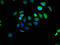 EF-hand domain-containing protein D1 antibody, CSB-PA880107LA01HU, Cusabio, Immunofluorescence image 