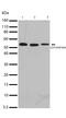 Mitogen-activated protein kinase kinase kinase 8 antibody, 710377, Invitrogen Antibodies, Western Blot image 