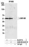 LSM Family Member 14B antibody, A305-851A-M, Bethyl Labs, Immunoprecipitation image 