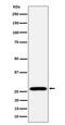 Ribosomal Protein L13 antibody, M06505, Boster Biological Technology, Western Blot image 