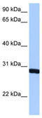 Survival Of Motor Neuron 2, Centromeric antibody, TA345684, Origene, Western Blot image 