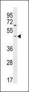 Rho Guanine Nucleotide Exchange Factor 35 antibody, 60-115, ProSci, Western Blot image 