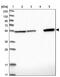 Aldehyde Dehydrogenase 7 Family Member A1 antibody, PA5-54750, Invitrogen Antibodies, Western Blot image 