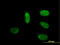 Mediator Complex Subunit 17 antibody, LS-B6197, Lifespan Biosciences, Immunofluorescence image 