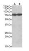 Heat Shock Protein Family A (Hsp70) Member 8 antibody, orb19293, Biorbyt, Western Blot image 