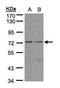 Fibronectin Leucine Rich Transmembrane Protein 1 antibody, TA309005, Origene, Western Blot image 