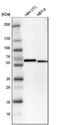 Serine/threonine-protein kinase 3 antibody, NBP1-89586, Novus Biologicals, Western Blot image 