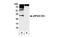 Replication Protein A2 antibody, NB100-544, Novus Biologicals, Western Blot image 