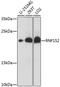 Ring Finger Protein 152 antibody, 16-676, ProSci, Western Blot image 