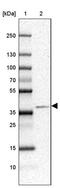 V-type proton ATPase subunit d 2 antibody, PA5-63109, Invitrogen Antibodies, Western Blot image 