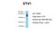 ETV1 antibody, ARP38528_P050, Aviva Systems Biology, Western Blot image 