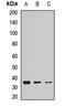 Charged multivesicular body protein 1a antibody, orb411864, Biorbyt, Western Blot image 