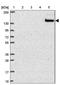 Sialic Acid Binding Ig Like Lectin 1 antibody, NBP2-30903, Novus Biologicals, Western Blot image 