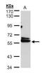 Chaperonin Containing TCP1 Subunit 4 antibody, PA5-27954, Invitrogen Antibodies, Western Blot image 