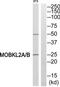 MOB Kinase Activator 3A antibody, TA316076, Origene, Western Blot image 