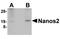 Nanos C2HC-Type Zinc Finger 2 antibody, NBP1-76370, Novus Biologicals, Western Blot image 