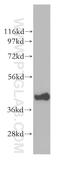 Eukaryotic translation initiation factor 3 subunit M antibody, 11423-1-AP, Proteintech Group, Western Blot image 