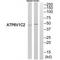 ATPase H+ Transporting V1 Subunit C2 antibody, A13193, Boster Biological Technology, Western Blot image 