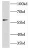 Dynactin Subunit 4 antibody, FNab02274, FineTest, Western Blot image 