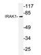 Interleukin 1 Receptor Associated Kinase 1 antibody, AP20311PU-N, Origene, Western Blot image 