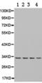 Enoyl-CoA Delta Isomerase 1 antibody, TA324027, Origene, Western Blot image 