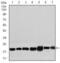 Ribosomal Protein L18a antibody, GTX60729, GeneTex, Western Blot image 