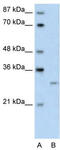 Protein CREG1 antibody, TA343427, Origene, Western Blot image 