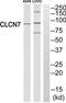 Chloride Voltage-Gated Channel 7 antibody, TA313629, Origene, Western Blot image 