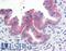 c-met antibody, LS-B2812, Lifespan Biosciences, Immunohistochemistry paraffin image 