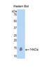 Oncostatin-M antibody, LS-C295721, Lifespan Biosciences, Western Blot image 