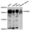 ERBB2 antibody, STJ113560, St John