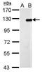 Zinc Finger Protein 711 antibody, GTX121177, GeneTex, Western Blot image 