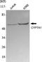 Cholesterol 7-alpha-monooxygenase antibody, M01601, Boster Biological Technology, Western Blot image 