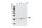 Voltage Dependent Anion Channel 1 antibody, 4866T, Cell Signaling Technology, Western Blot image 