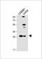 Lysosomal Protein Transmembrane 5 antibody, A09673, Boster Biological Technology, Western Blot image 