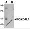 Forkhead Box D4 Like 1 antibody, 6693, ProSci, Western Blot image 