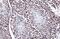 Tet Methylcytosine Dioxygenase 1 antibody, GTX627420, GeneTex, Immunohistochemistry paraffin image 