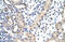 Small nuclear ribonucleoprotein Sm D1 antibody, 29-397, ProSci, Immunohistochemistry frozen image 