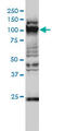 General Transcription Factor IIIC Subunit 2 antibody, LS-C133227, Lifespan Biosciences, Western Blot image 