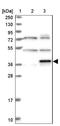 MAGE Family Member B6 antibody, NBP1-84353, Novus Biologicals, Western Blot image 