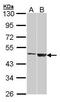 Galactose-3-O-Sulfotransferase 1 antibody, PA5-21580, Invitrogen Antibodies, Western Blot image 