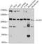 ArfGAP With Coiled-Coil, Ankyrin Repeat And PH Domains 2 antibody, A09294, Boster Biological Technology, Western Blot image 