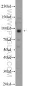 N(Alpha)-Acetyltransferase 15, NatA Auxiliary Subunit antibody, 23845-1-AP, Proteintech Group, Western Blot image 