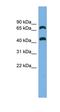 Cysteine And Histidine Rich Domain Containing 1 antibody, orb325938, Biorbyt, Western Blot image 