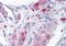 Metastasis Associated 1 antibody, orb18683, Biorbyt, Immunohistochemistry paraffin image 