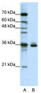 Musashi RNA Binding Protein 2 antibody, TA343987, Origene, Western Blot image 