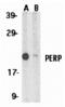 P53 Apoptosis Effector Related To PMP22 antibody, MBS151420, MyBioSource, Western Blot image 