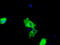Bruton Tyrosine Kinase antibody, TA501119, Origene, Immunofluorescence image 