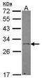 EFNA3 antibody, GTX101455, GeneTex, Western Blot image 