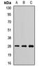 Proteasome Subunit Alpha 7 antibody, orb412237, Biorbyt, Western Blot image 